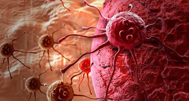 Presentan nueva alternativa inmuno – oncológica para pacientes con cáncer renal y cáncer de vejiga